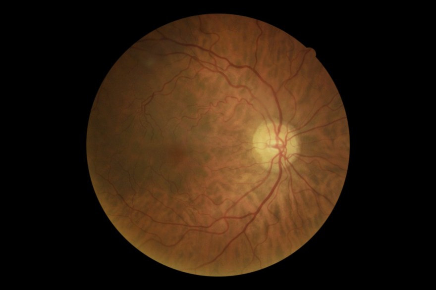 Boesenberg_Anthea_502